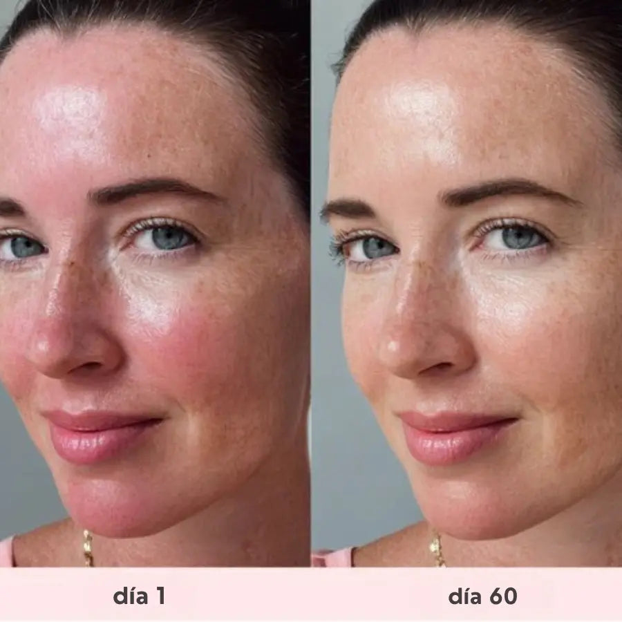 VELYRA™ Mascarilla facial terapéutica